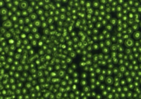 Tcells in green on a black background